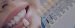 Teeth Whitening in Airdrie